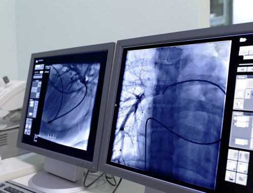 coronary angioplasty and stent treatments in Tulsa Oklahoma
